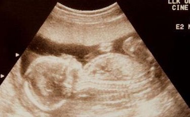 分享2026年拉萨三代试管婴儿比较好私立医院排名、拉萨怀孕机构排名